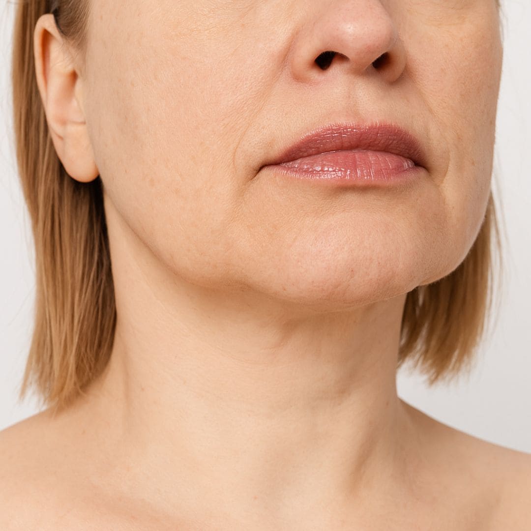 Avant la crème medi-peel peptide 9
