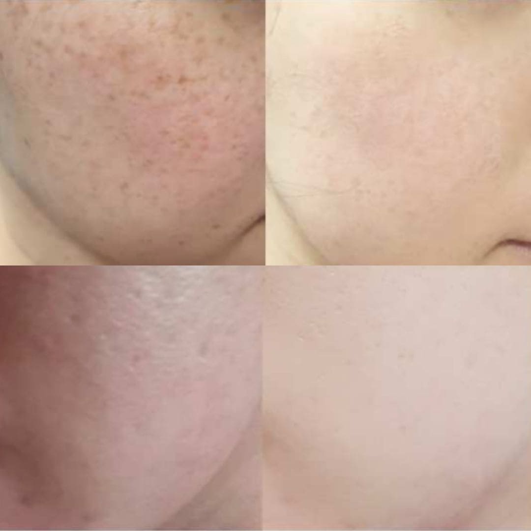 Cell Happy Co Crème hydratante anti-tâches avant après