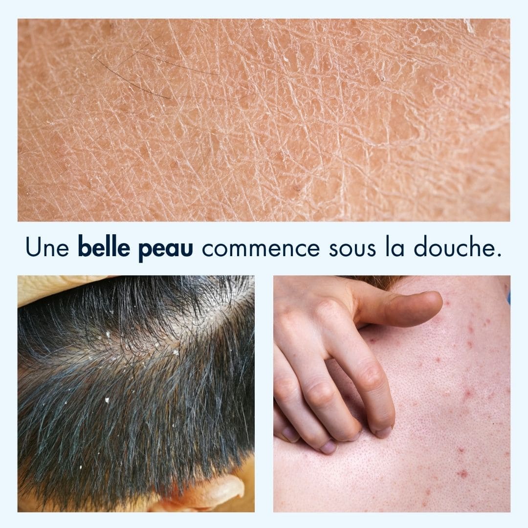 pommeau onsha home sur la peau