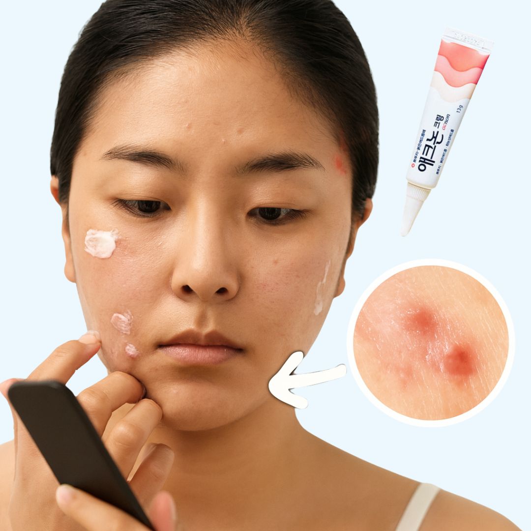 Acnon crème anti-acné pour boutons inflammatoires boutons