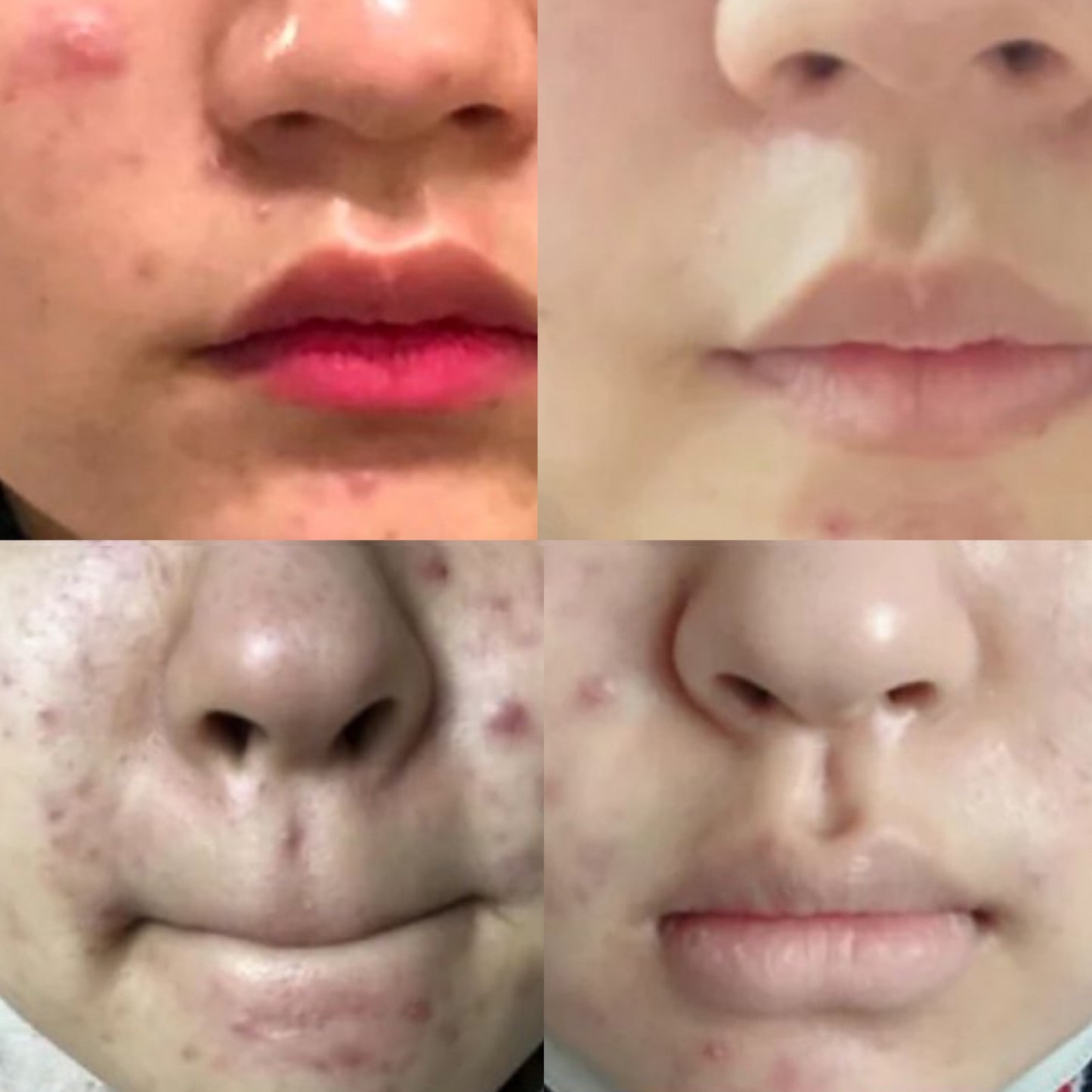 Numbuzin sérum anti imperfections avant après 2