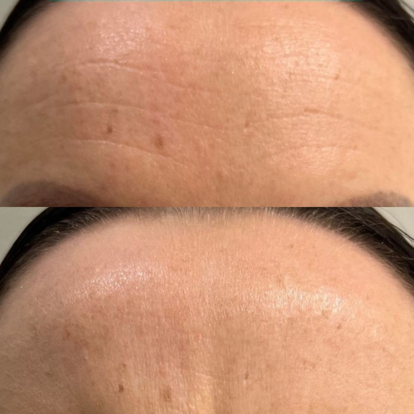 Medicube crème gelée avant après