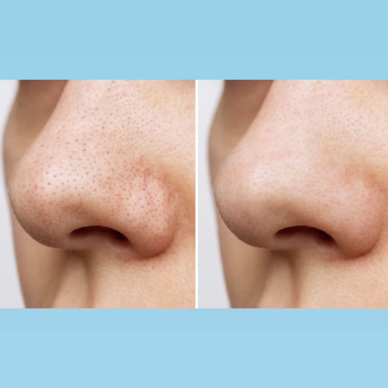 Round Lab - Pads hydratants Dokdo 1025 - 70 pads