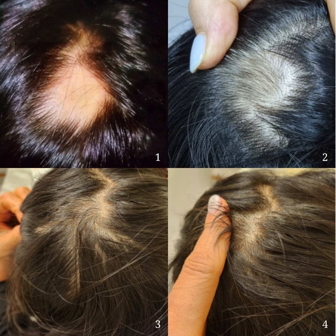 Cell Happy Co toner anti-chute de cheveux avant-après