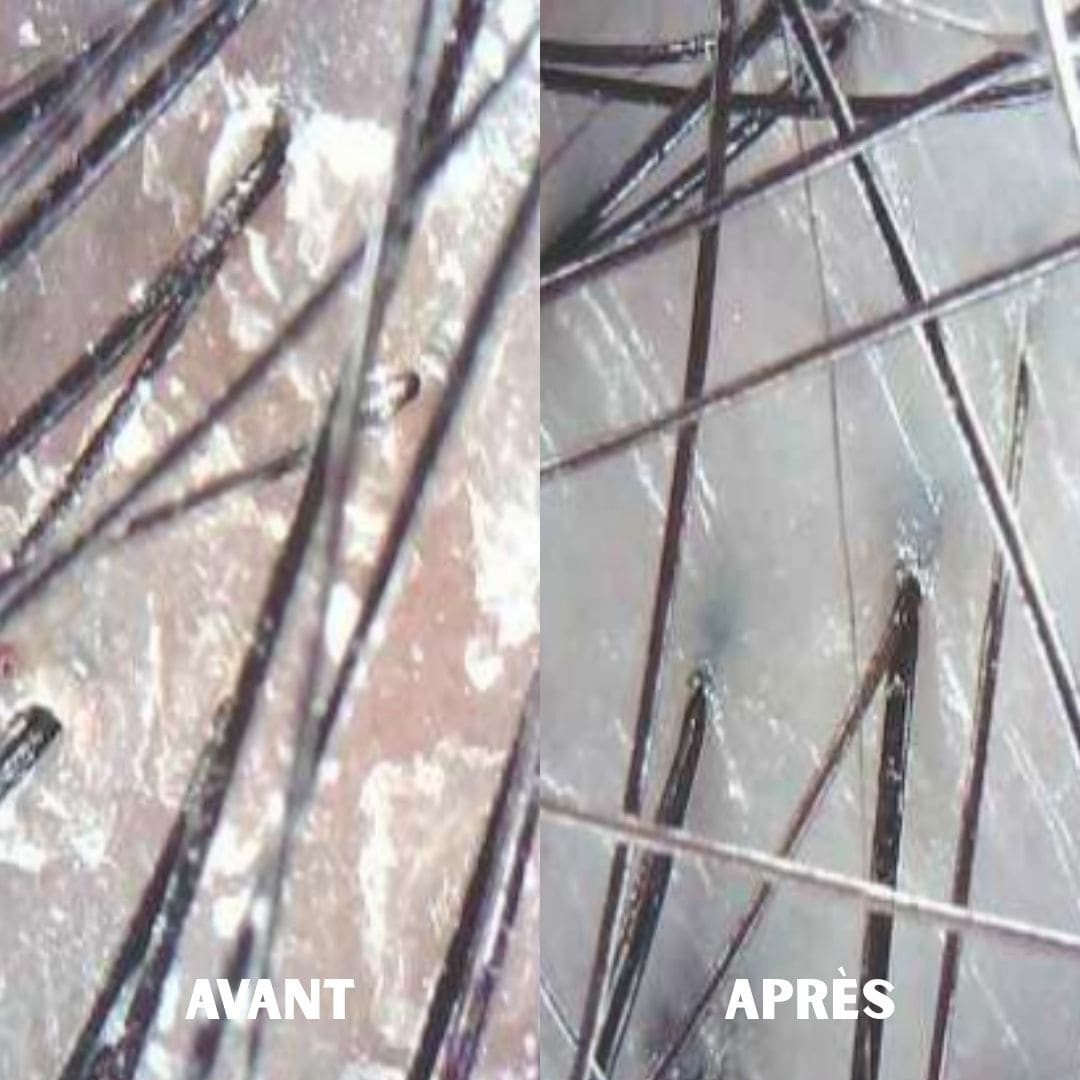 Cell Happy Co toner anti-chute de cheveux avant après cuir chevelu