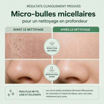 Avant après utilisation du nettoyant moussant 30 secondes pour des pores nets de Menokin