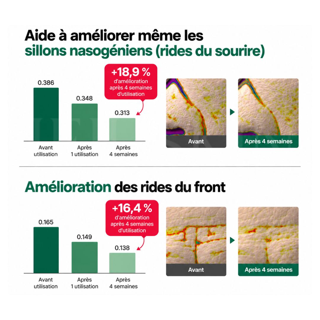 Avant après sur les rides du sourir de la crème anti-âge raffermissante et régénérante de Nine Tails