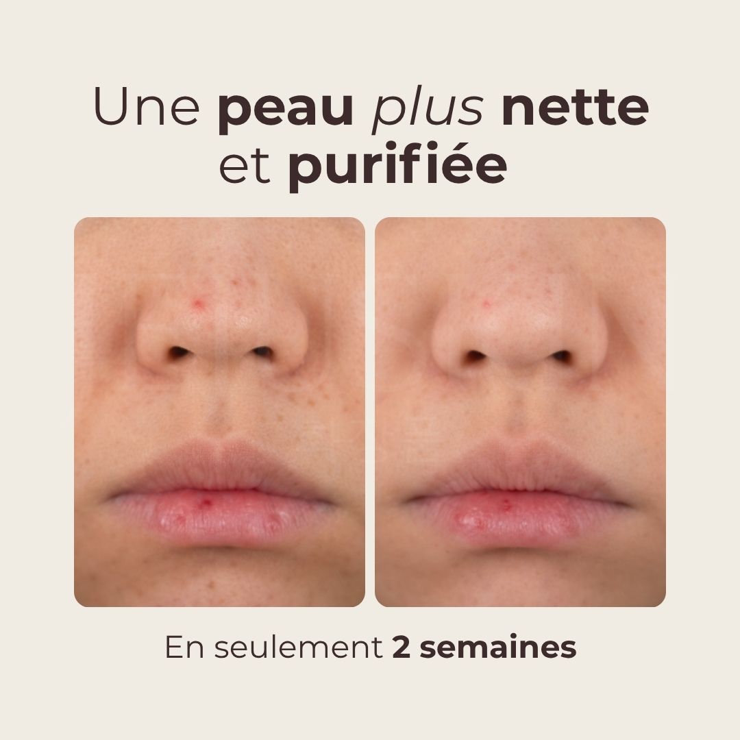 avant après utilisation du toner lacté éclat à l’eau de riz de Mizon
