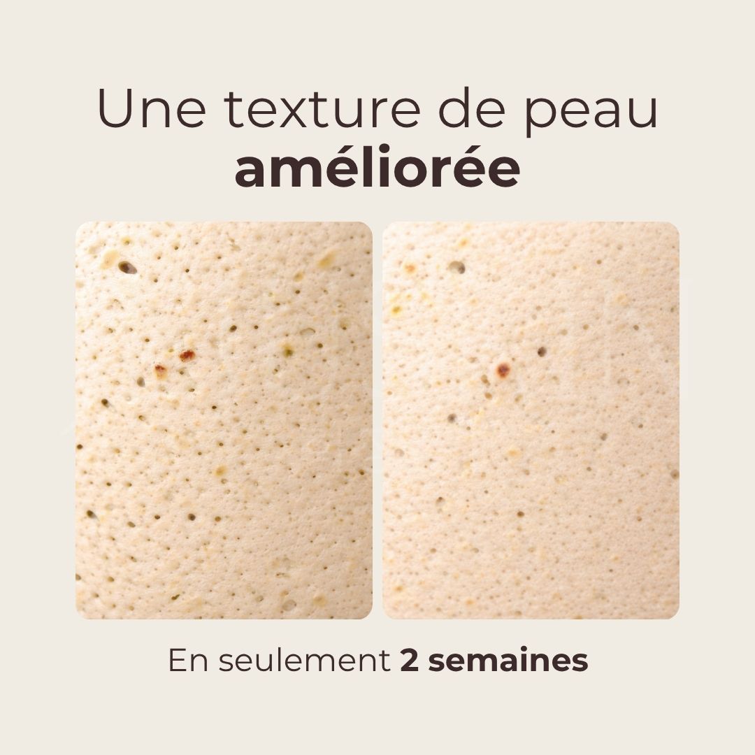 Avant après sur les pores du toner lacté éclat à l’eau de riz de Mizon