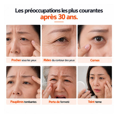 Les préoccupation sur la peau les plus courantes des gens après 30 ans