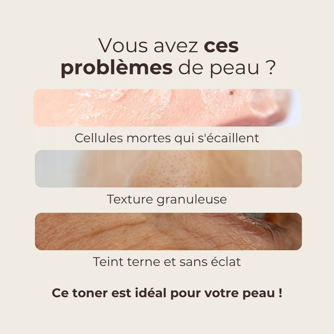 Pour qui est fait le toner lacté éclat à l’eau de riz de Mizon