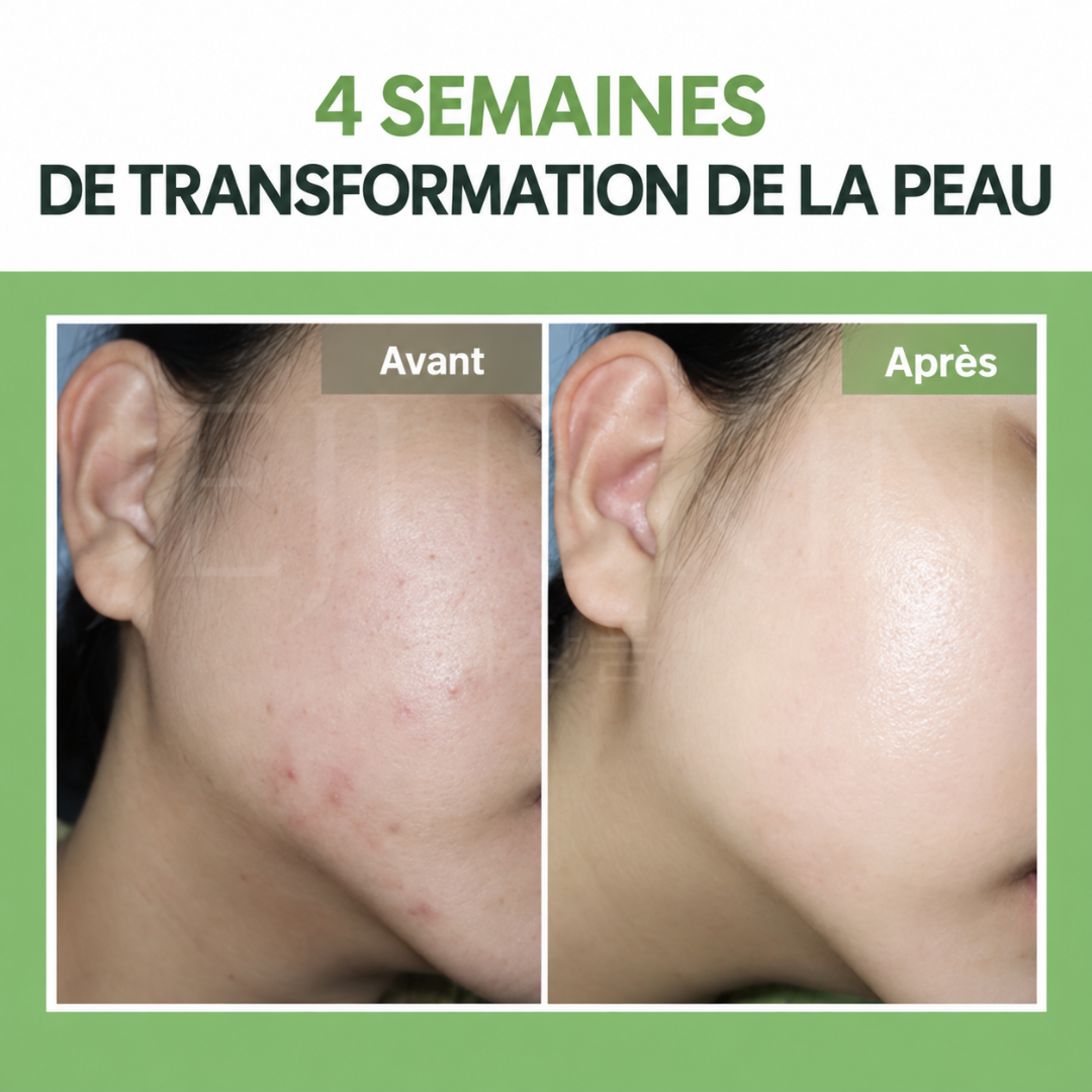 Avant après utilisation du nettoyant moussant purifiant au Noni de Celimax