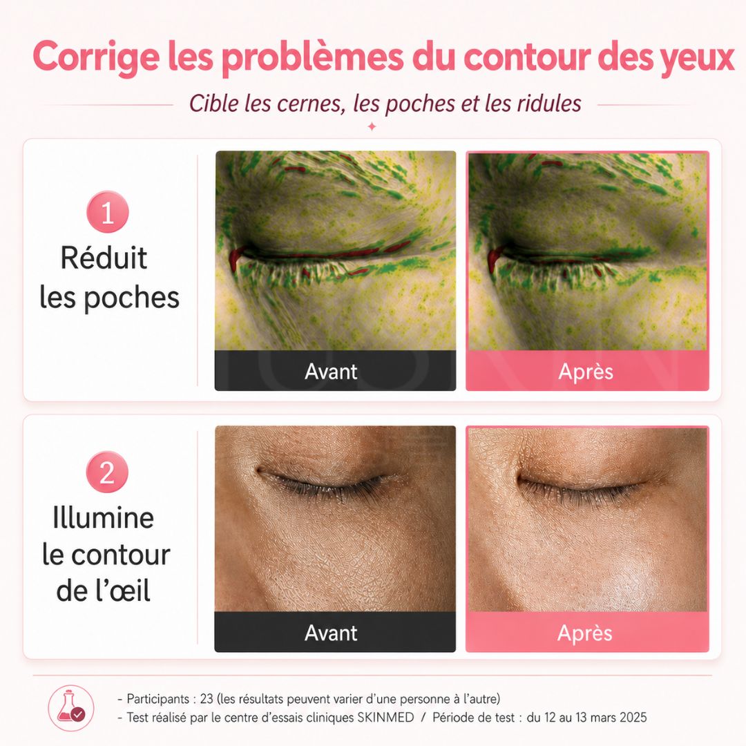 Avant après utilisation des patchs en gel pour les yeux au PDRN d'Abib