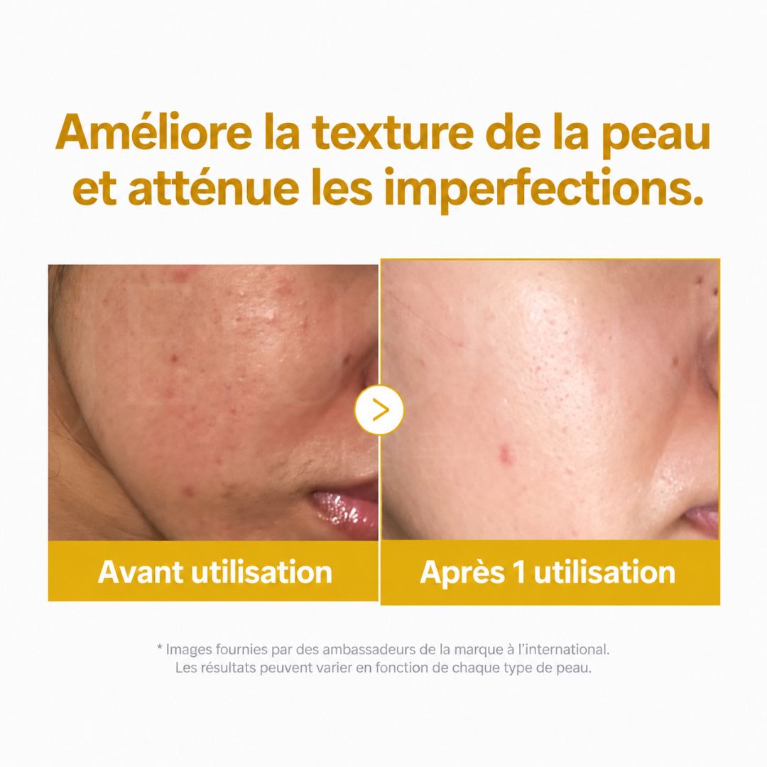 Avant après avoir utilisé le masque de nuit à l’acide kojique et au curcuma de Medicube