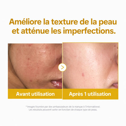 Avant après avoir utilisé le masque de nuit à l’acide kojique et au curcuma de Medicube