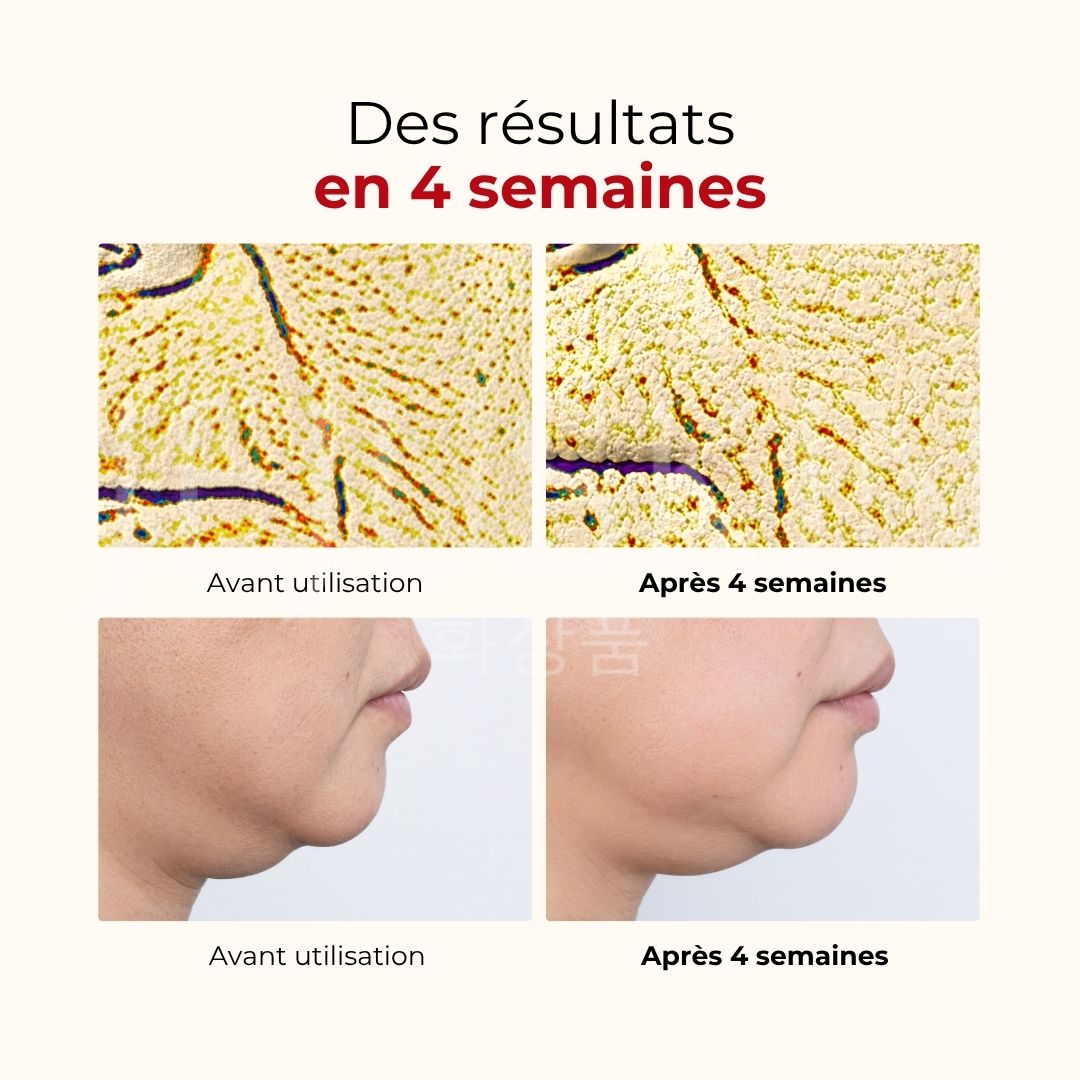 Avant après utilisation de la crème anti-âge et réparatrice Madeca de Centellian24