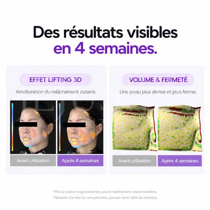 Résultats après 4 semaines d'utilisation du toner essentiel raffermissant Probioderm 3D Lifting de Bioheal Boh