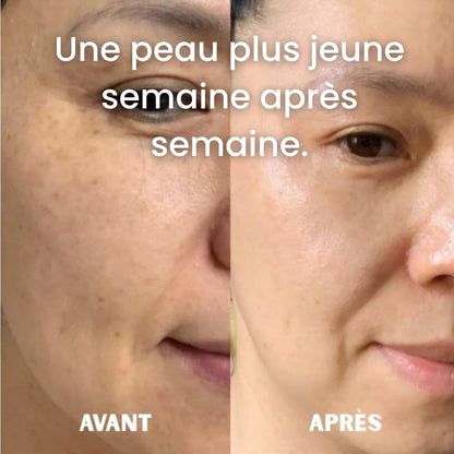 Résultat avant et après utilisation des sérums vitamine C Cell Happy Co.
