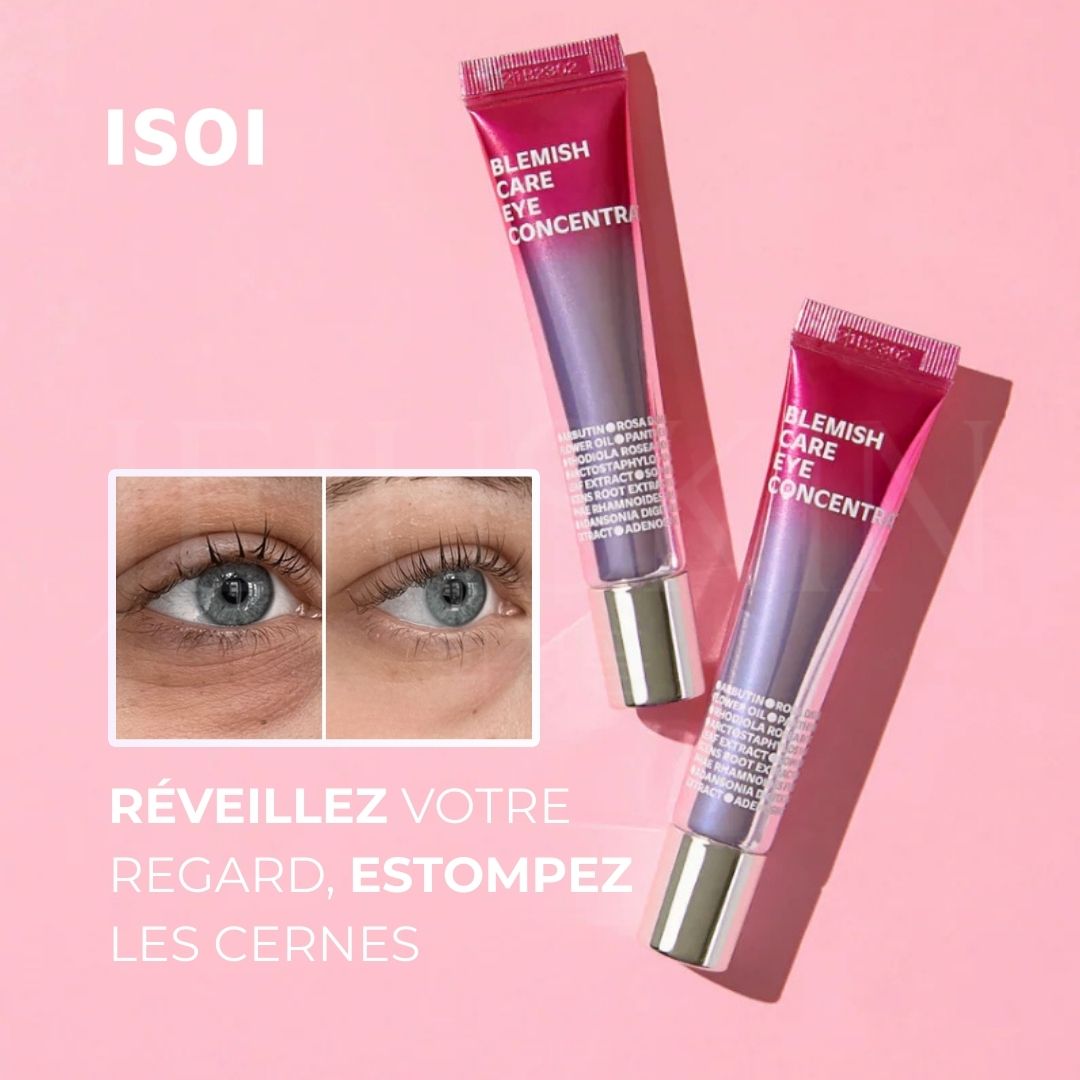 Le bénéfice de la crème pour les yeux d'Isoi