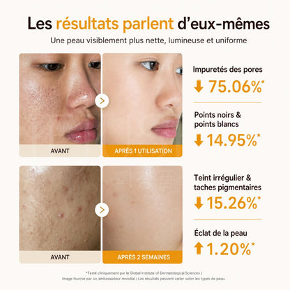 Avant après utilisation du peeling anti-taches à l’acide kojique et curcuma de Medicube
