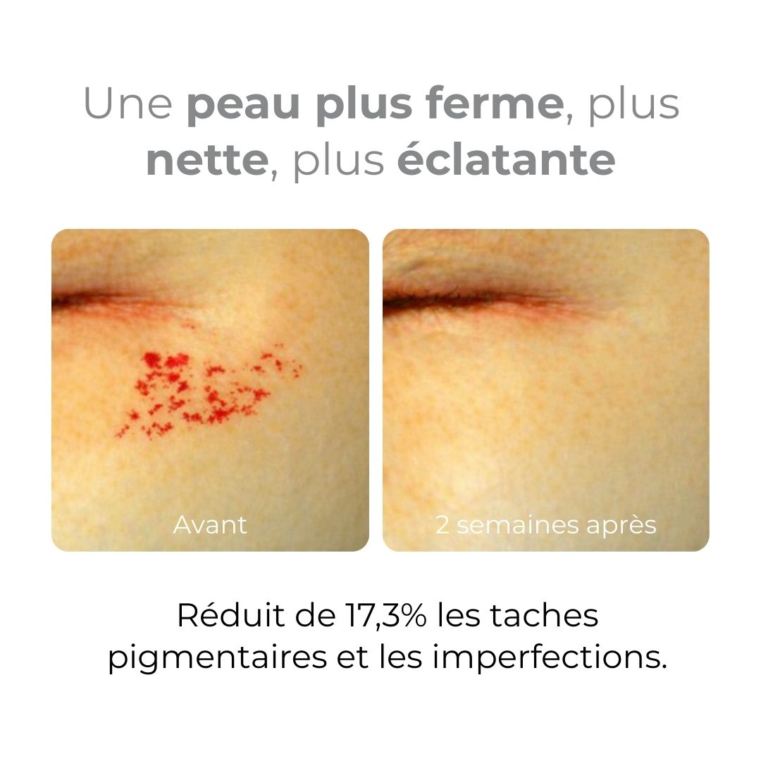 Equlib masque en gel hydratant Melavita avant après