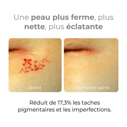 Equlib masque en gel hydratant Melavita avant après