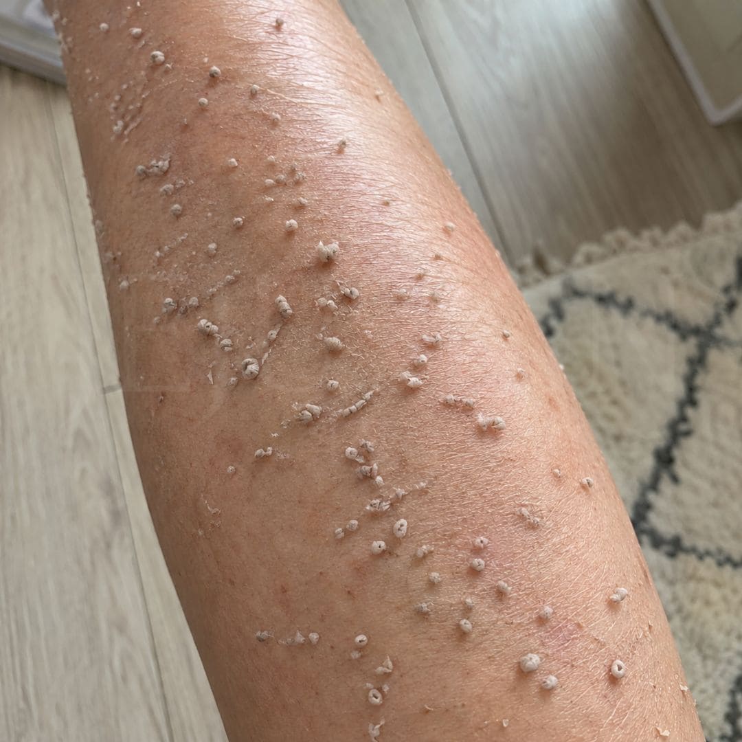 Texture du peeling pour le corps à l’acide hypochloreux de Medicube