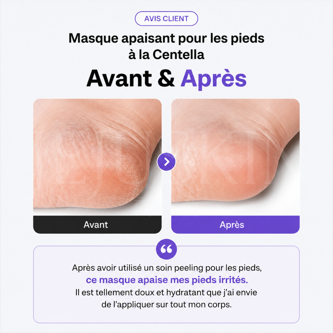 Avant après utilisation du masque apaisant pour les pieds à la Centella de Baren