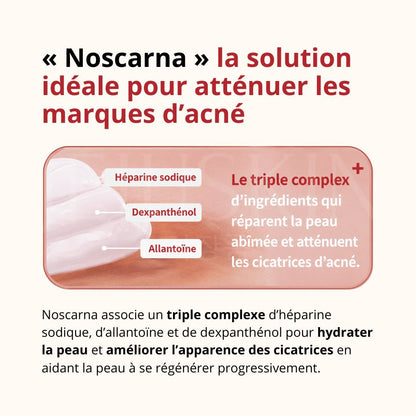 Les bienfaits du gel réparateur pour cicatrices et imperfections de noscarna
