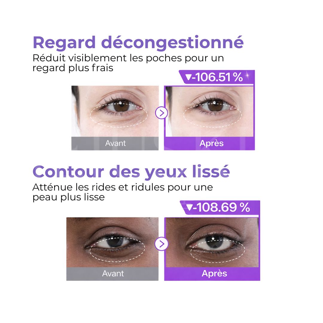 Avant après l’utilisation des patchs contour des yeux revitalisants NAD+