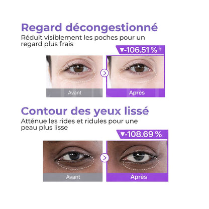 Avant après l’utilisation des patchs contour des yeux revitalisants NAD+