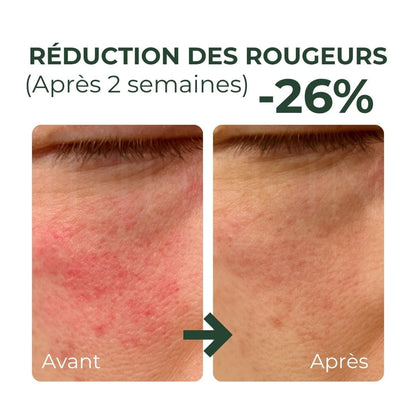 Purito SEOUL Crème apaisante pour le contour des yeux à la Centella avant après