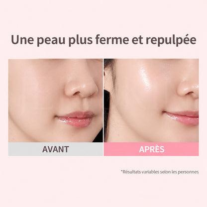 Avant après utilisation du baume hydratant anti-rides Vita MQNY au collagène de Macqueen