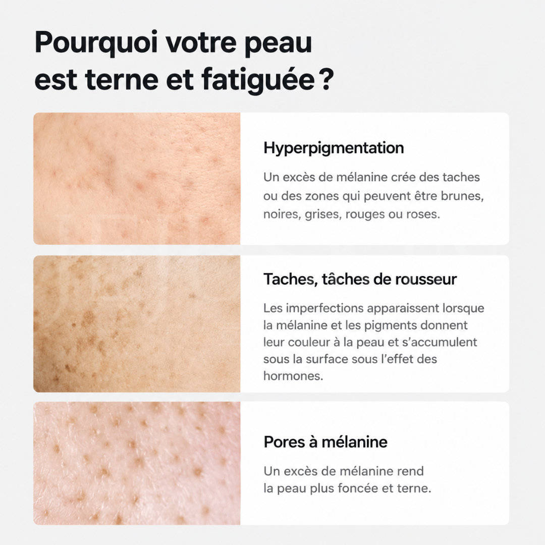 Pourquoi votre peau est fatiguée sérum éclat anti-taches et pores de Celimax