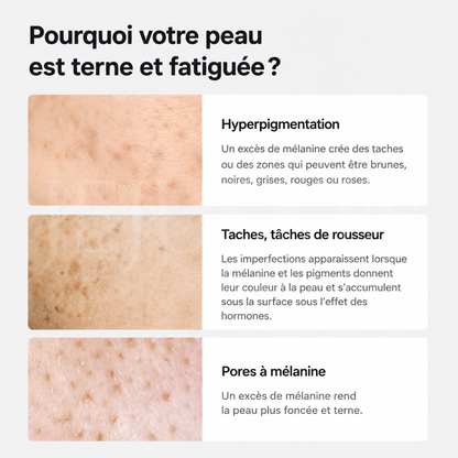Pourquoi votre peau est fatiguée sérum éclat anti-taches et pores de Celimax
