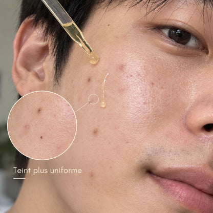 Homme qui utilise le sérum anti-taches B-Boost à 1% d’acide kojique de Nineless
