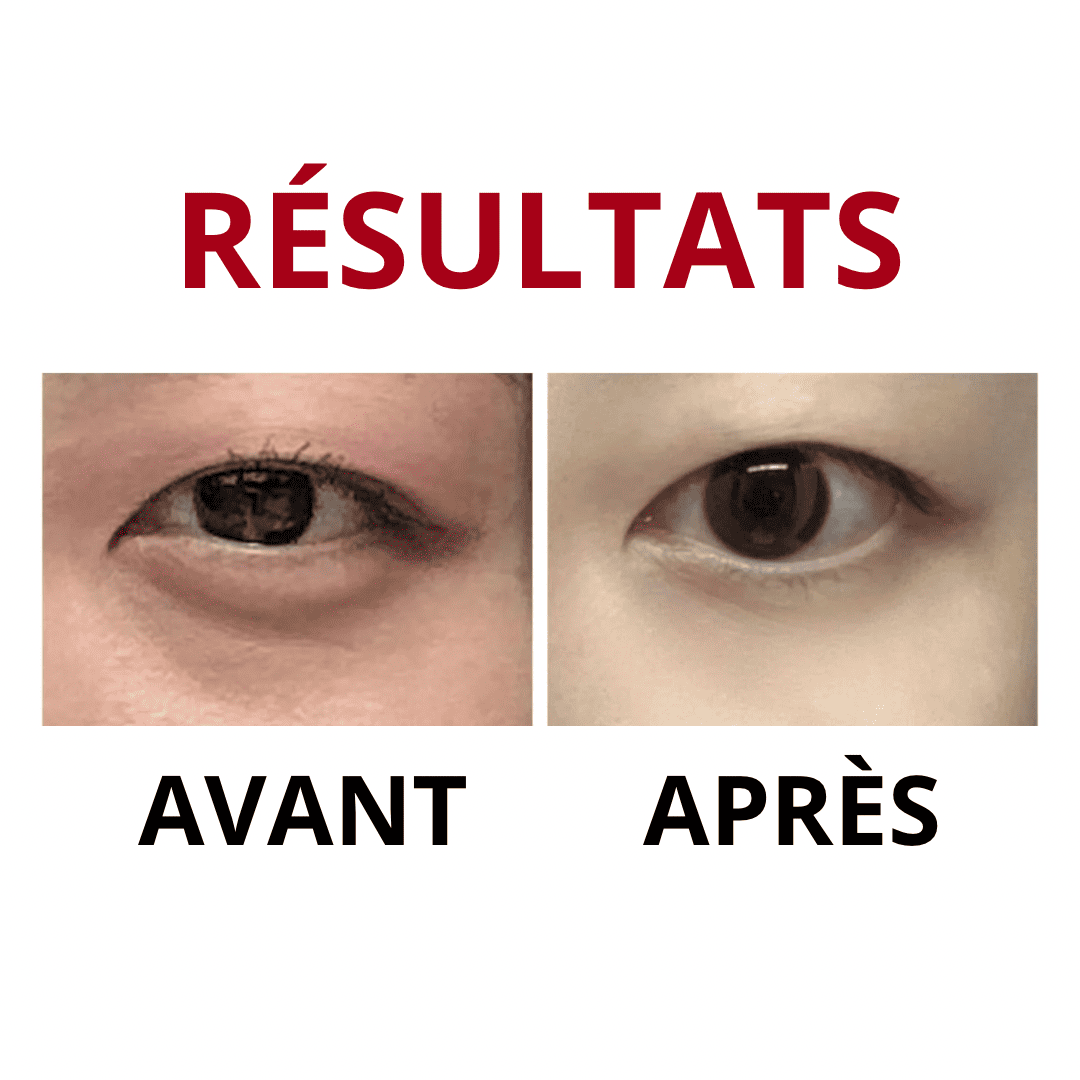 Meditherapy Crème pour le contour des yeux anti-rides Wrinkle-Fit résultats