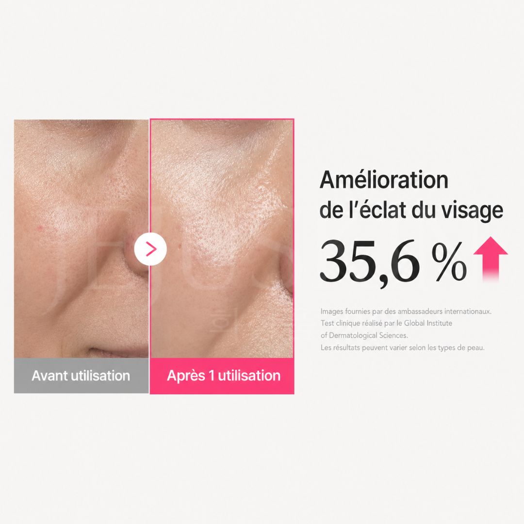 Avant après utilisation du sérum gelée repulpant au PDRN et collagène de Medicube