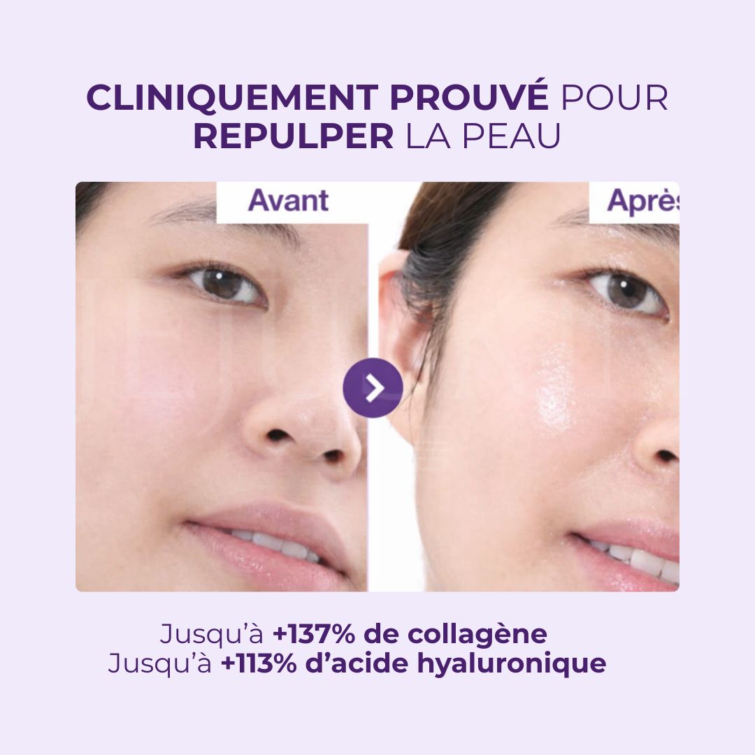 Un avant après utilisation du toner Booster d’Éclat NAD+ et PDRN No.9 de Numbuzin