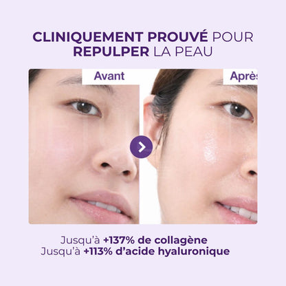 Un avant après utilisation du toner Booster d’Éclat NAD+ et PDRN No.9 de Numbuzin