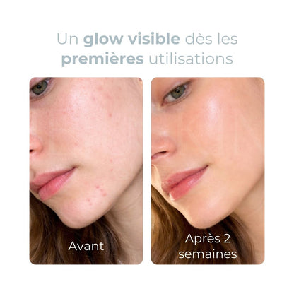 Equlib toner pads hydratants Eau Briller avant après
