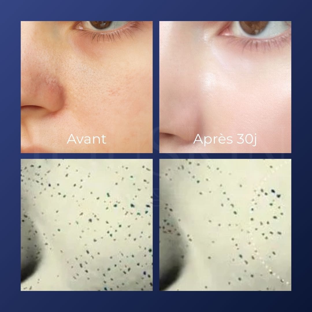 Medicube Crème hydratante Zero Pore 50ml avant après