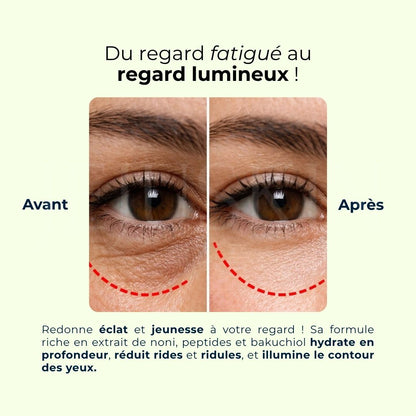 Avant après utilisation de la crème contour des yeux Noni Ultimate de Celimax