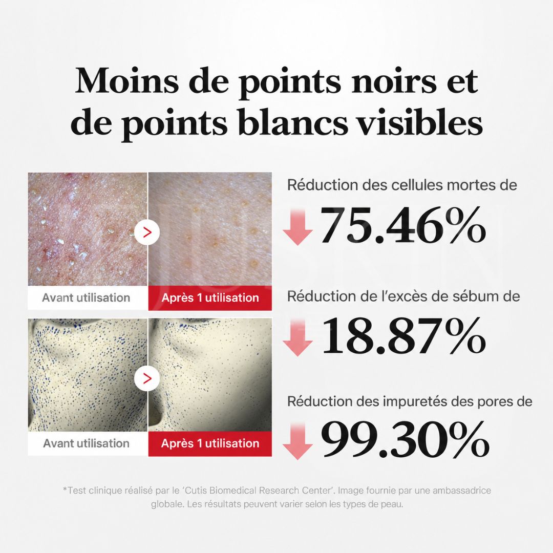 Avant après avoir utilisé l'exfoliant visage doux à l’acide hypochloreux de Medicube