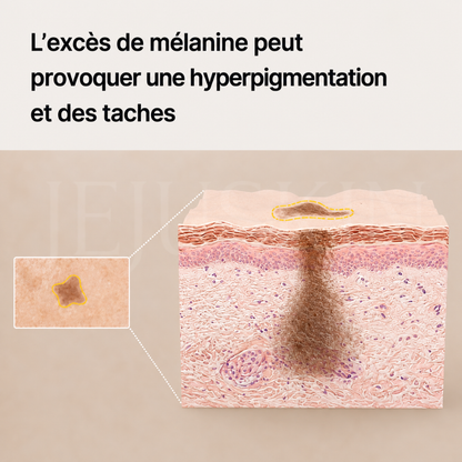 Les tâches brunes sur la peau  