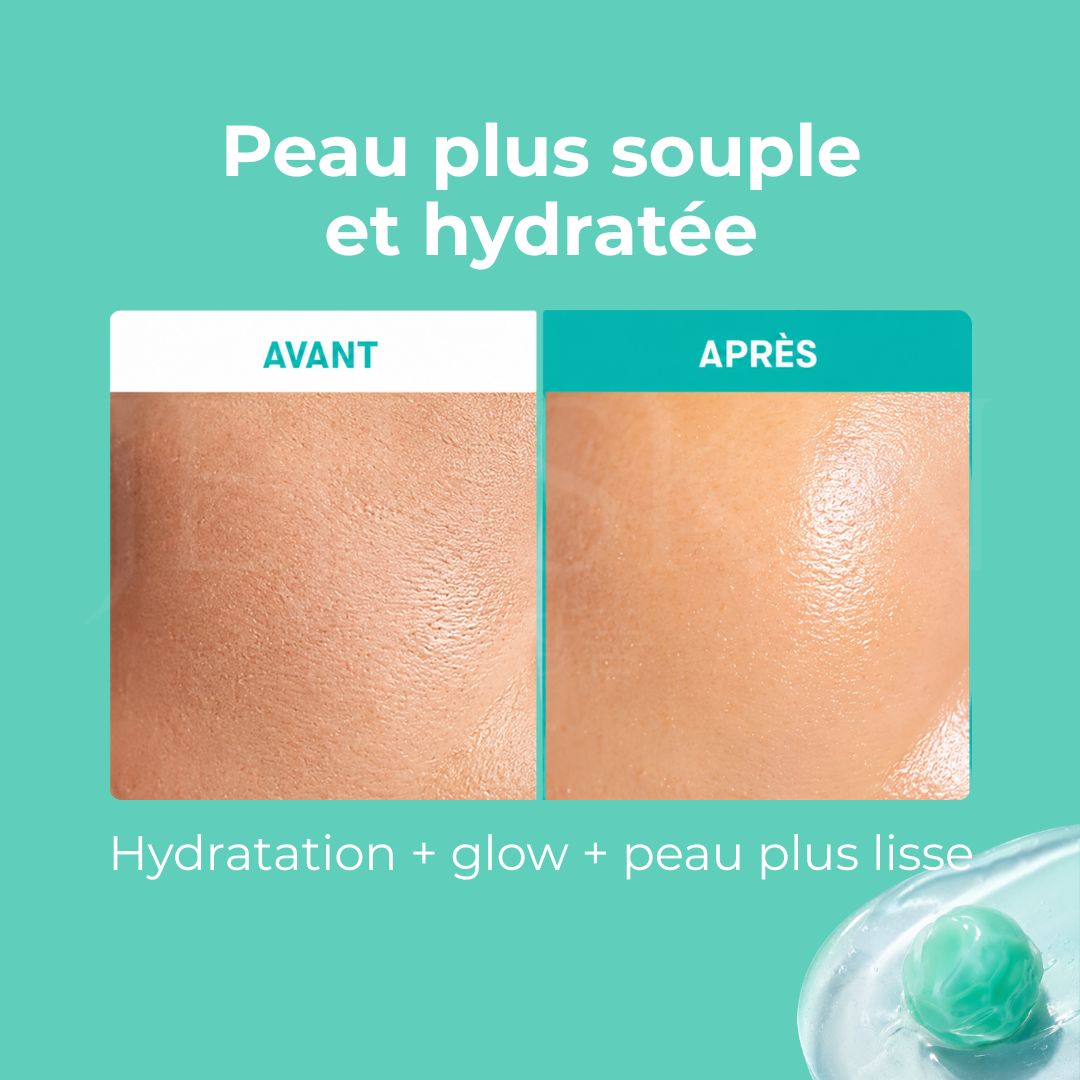 Avant après utilisation de la crème capsules régénérante au PDRN  de VT cosmetics