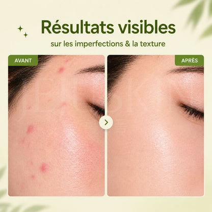 Avant après utilisation du nettoyant doux au haricot mungo de Beplain
