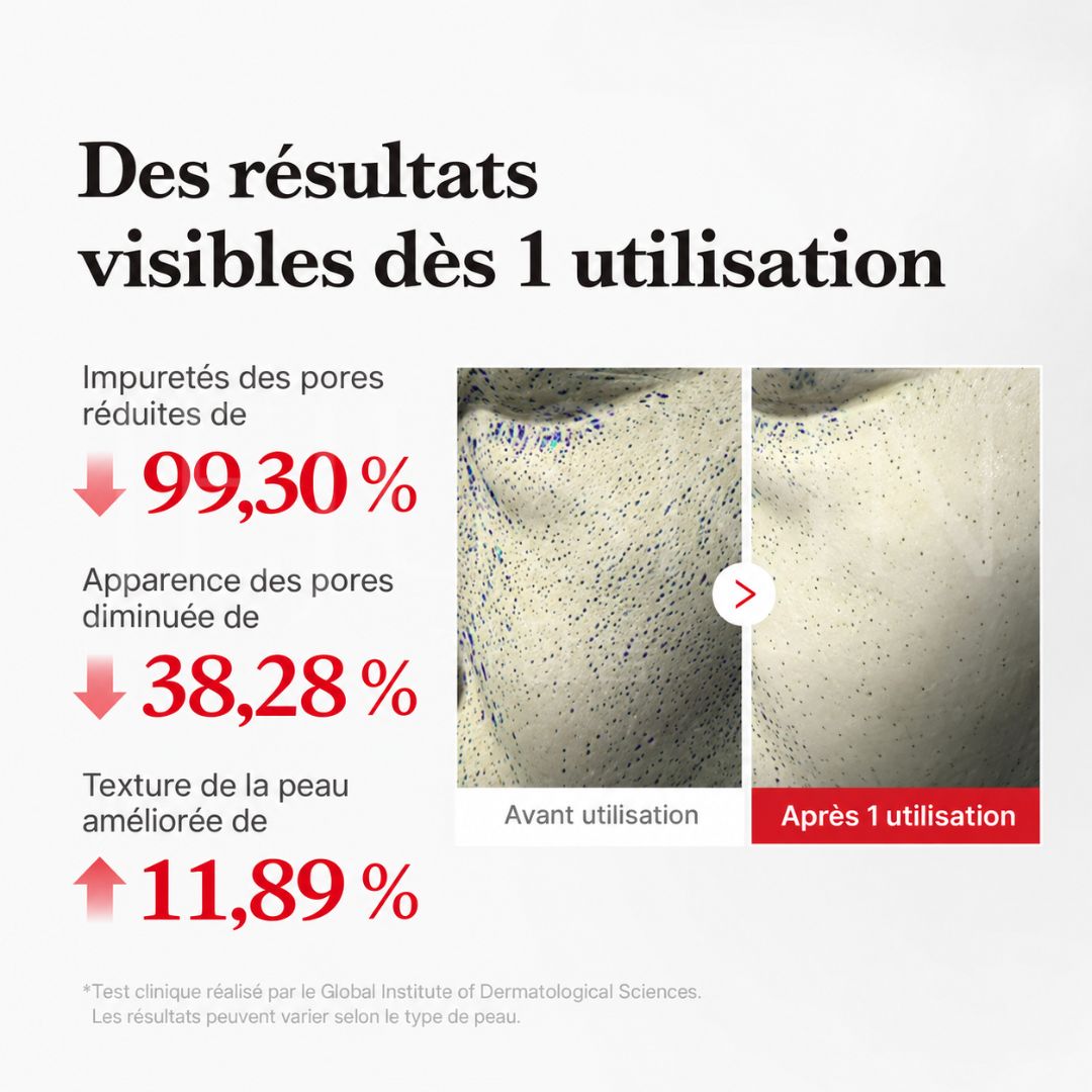 L'effet de l'exfoliant visage doux à l’acide hypochloreux de Medicube sur les pores