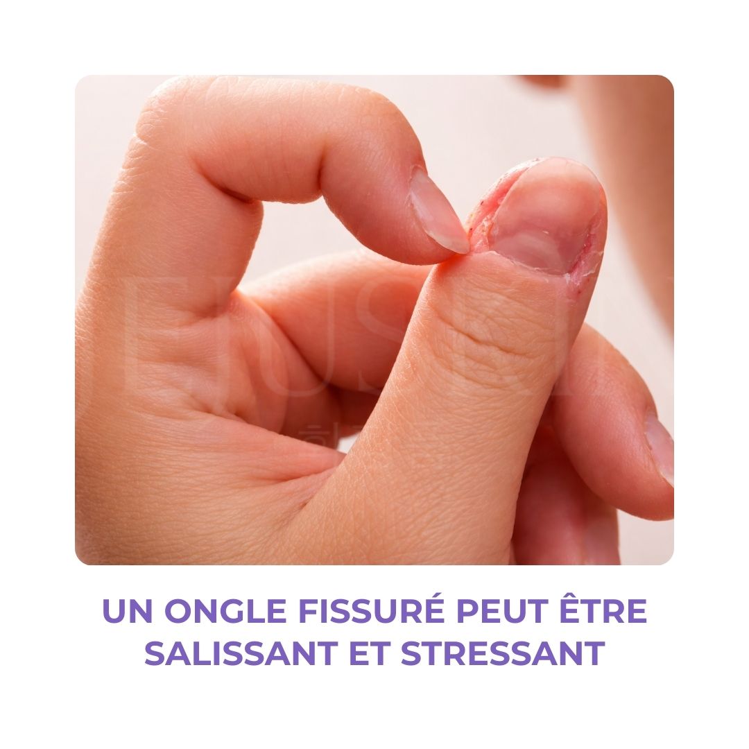 Stylo Baren ongles qui cassent