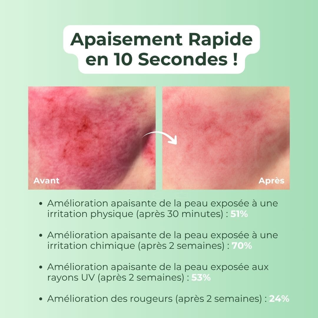 Purito SEOUL Crème hydratante à la Centella Asiatica avant après